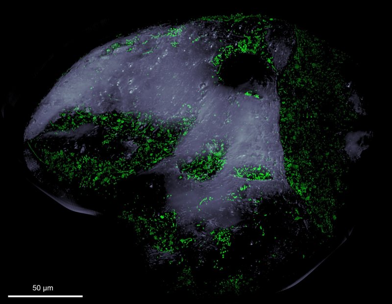 View of a sand grain under a fluorescence microscope: The green spots are stained bacteria, which have mainly colonized depressions on the grain. 