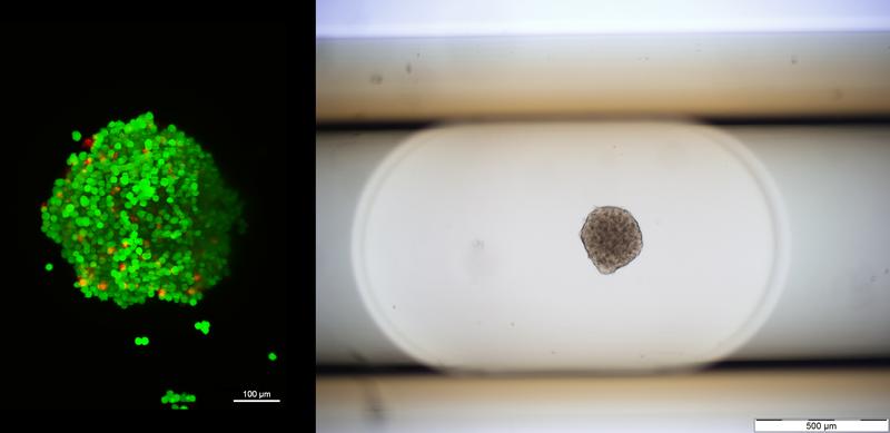 Abb. 2: Vitalitätsanalyse eines Sphäroides der Zelllinie 215 mittels Lichtblattmikroskopie Z.1 (LSFM), Lebend/Tot-Färbung (links) und Aufnahme eines Sphäroides im Kompartiment (rechts).
