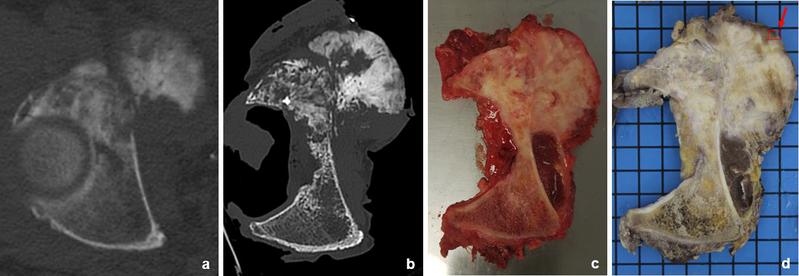 Abb. 2, : Vergleichende Visualisierung anatomisch präziser Gewebeschnitte