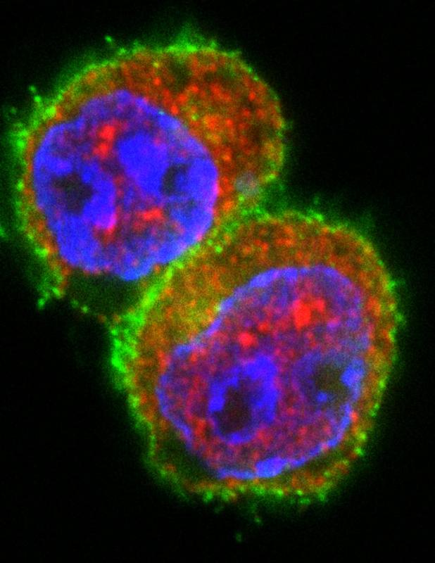 T-Zellen nach Stimulation in Gegenwart von miRNA181a. Immunfluoreszenzfärbung von T-Zellen (grün: T-Zellmarker CD4, rot: Transkriptionsfaktor NFAT5, blau: Zellkern). 