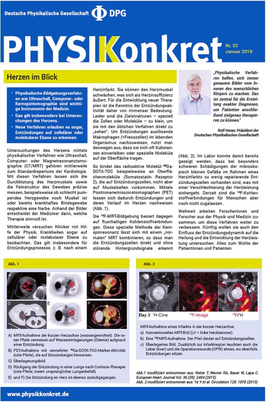 Ein neues Physikkonkret der DPG beschreibt Methoden, wie die Medizin mit physikalischen Bildgebungsverfahren Entzündungen am Herzen diagnostizieren kann.