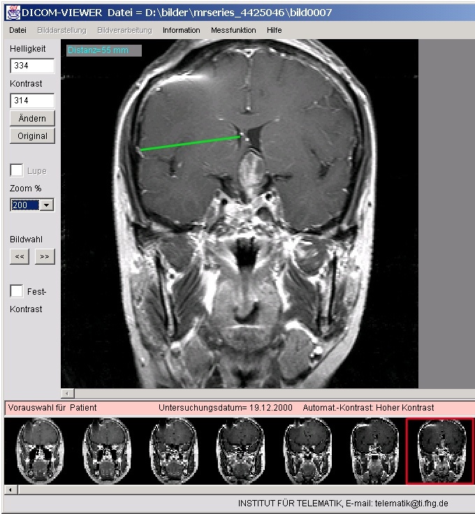 Röntgenbilder vom Kopf können dank des mitgelieferten Viewers auf jedem PC betrachtet und ausgedruckt werden. ©Institut für Telematik