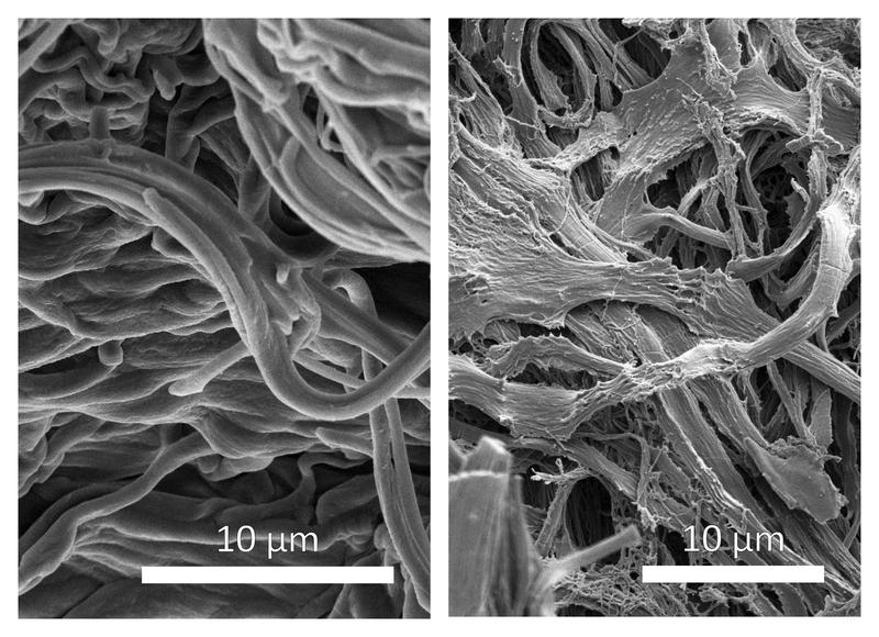 Spuren der Zeit auf der Mikrostrukturebene: Rasterelektronenmikroskopische Aufnahmen von Elastinfasern der Haut eines 6- (l.) und 90-jährigen (r.) Probanden.