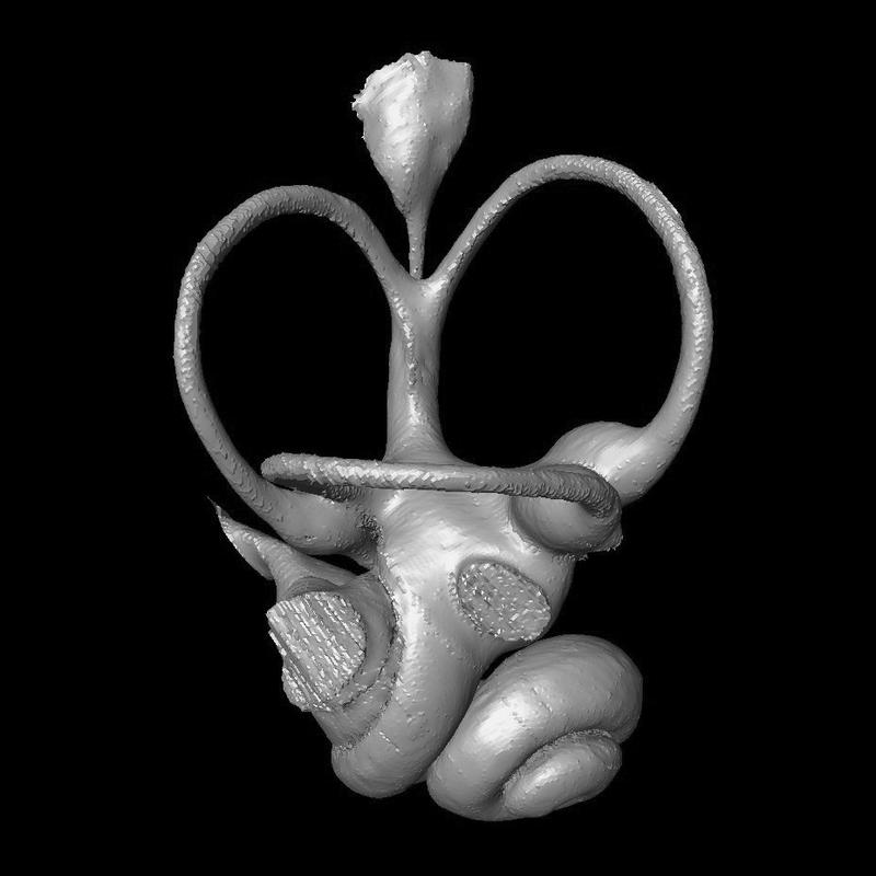 3D-Darstellung des Innenohr-Hohlraums im Felsenbein