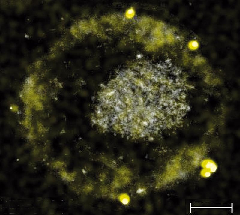 Das Bakterium C. metallidurans bildet winzig kleine Gold-Nuggets.