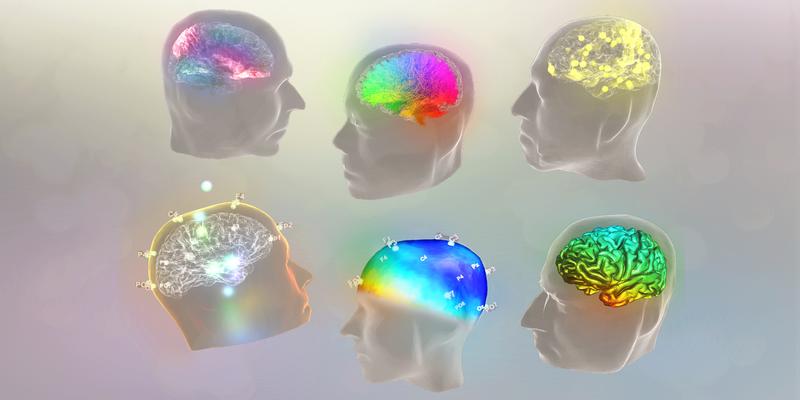 The Virtual Brain ist eine Open-source-Software zur personalisierten Simulation von Gehirnen