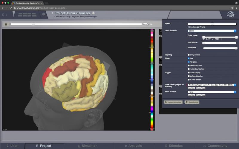 Die Virtual-Brain-Software im Einsatz