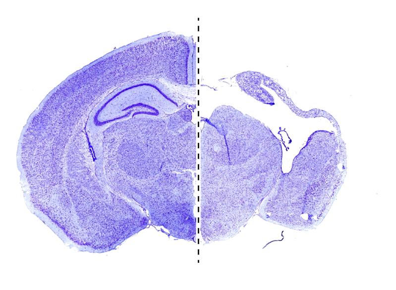 Composition of two mouse brain sections: left the brain of a healthy, juvenile mouse, right the equivalent without Vps15. Scientists linked this gene to defects in brain development in 