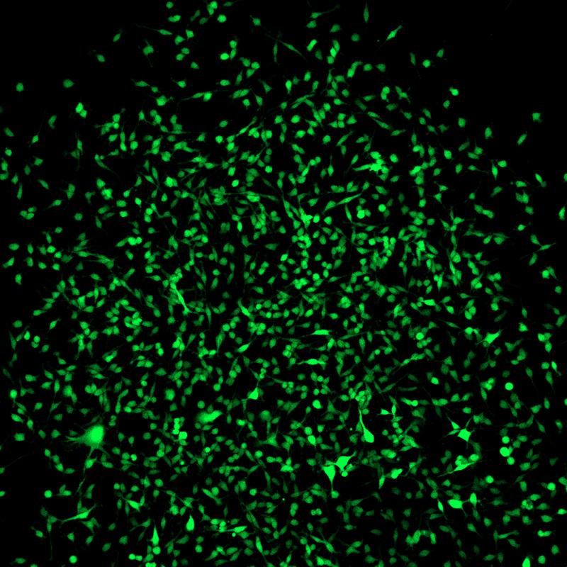 Scientists at the University of Bonn have found a way to specifically mark multipotent stromal cells. These cells therefore light up green in the microscope image. 