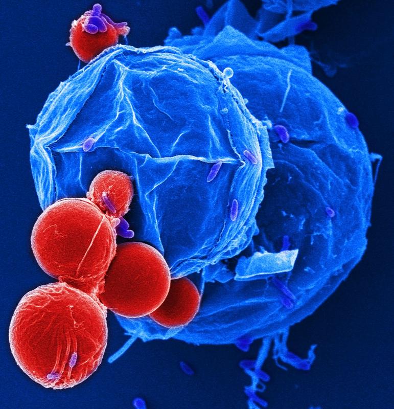 REM-Aufnahme von Vitrella brassicaformis, einer photoautotrophen Verwandten der Toxoplasmose- und Malaria-Erreger. Sporangien und vegetative Zellen sind blau, bzw. rot eingefärbt.
