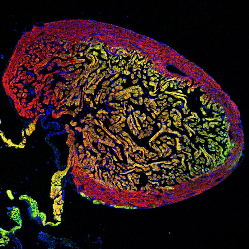Schnitt durch ein Zebrafischherz mit zwei unterschiedlichen Muskelzellschichten (gelb und rot). Die regenerierenden Zellen des gelben Bereichs können auch zum Wiederaufbau der roten Schicht beitragen