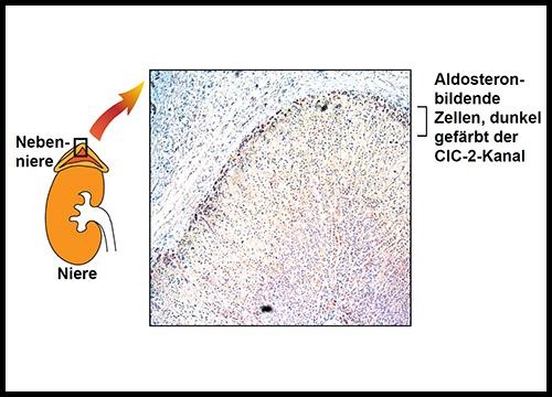Bei der familiären Form von Hyperaldosteronismus ist ein Gen mutiert, dass die Information für den Bau des CIC-2-Kanals in der Zellmembran trägt. 