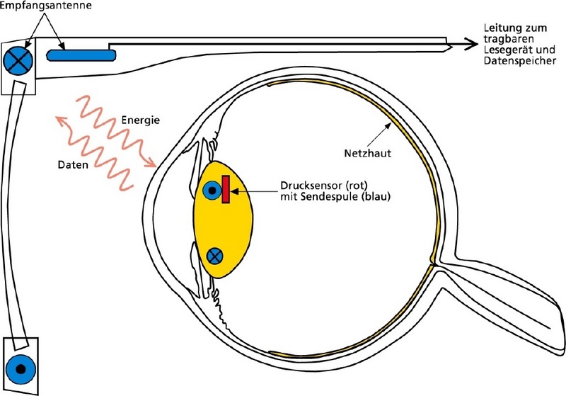 Eine spezielle Brille liefert Energie und nimmt Messwerte auf. ©Fraunhofer IMS