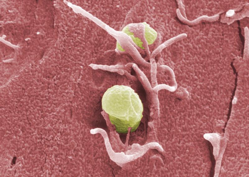 Bacteria of the species Yersinia pseudotuberculosis invade human tissue.