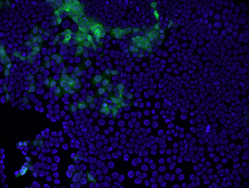 Die grüne Immunfärbung des Hepatitis E Virus Kapsidproteins in den Plazentazellen weist die Replikation des Virus in diesen nach.