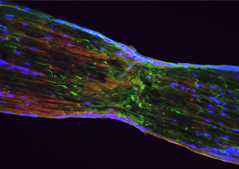 Ein geschädigter Ischiasnerv. Das Enzym NOX2 (rot) produziert die zur Regeneration benötigten freien Sauerstoffradikale. Es wird von Axonen (grün) der verletzten Nervenzellen aufgenommen. 