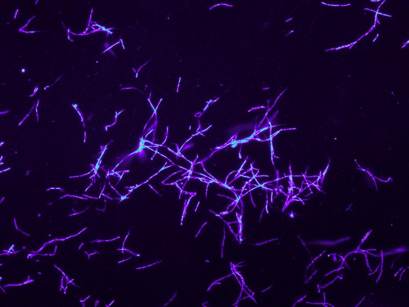 Die Fluoreszenz-in-situ-Hybridisierung (FISH) macht die Verteilung symbiotischer Streptomyces Bakterien im Antennensekret eines Europäischen Bienenwolf-Weibchens (Philanthus triangulum) sichtbar.