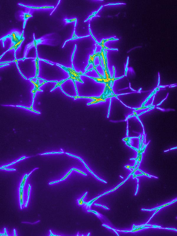 By means of fluorescence in situ hybridization (FISH) the distribution of symbiotic Streptomyces bacteria in the antennal secretions of a female European beewolf (P. triangulum) can be visualized.