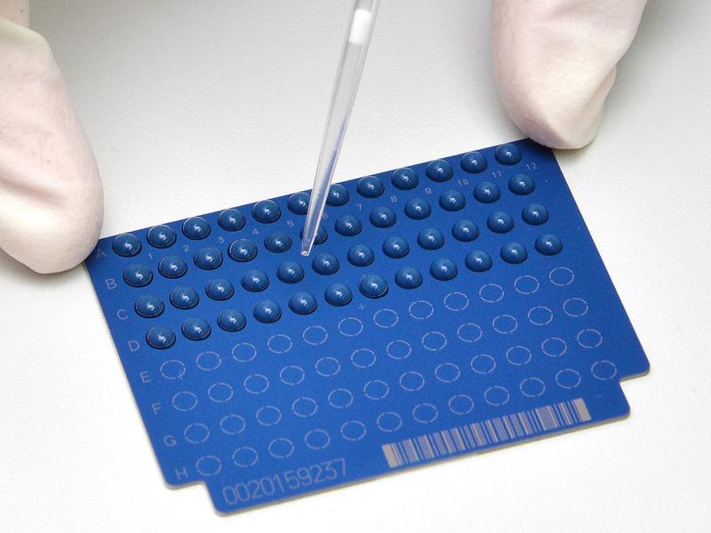 Symbolic picture: Application of microdroplets for rapid determination of resistance using MALDI-TOF mass spectrometry