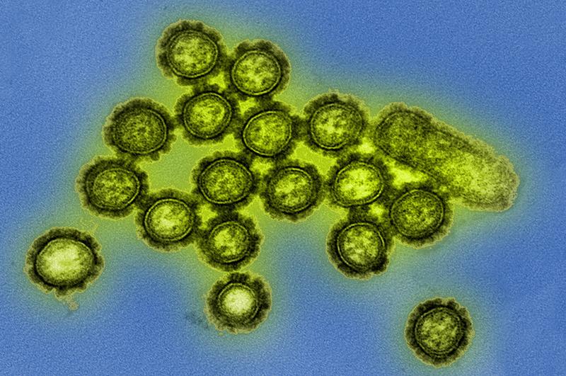 Particles of the H1N1 influenza virus.