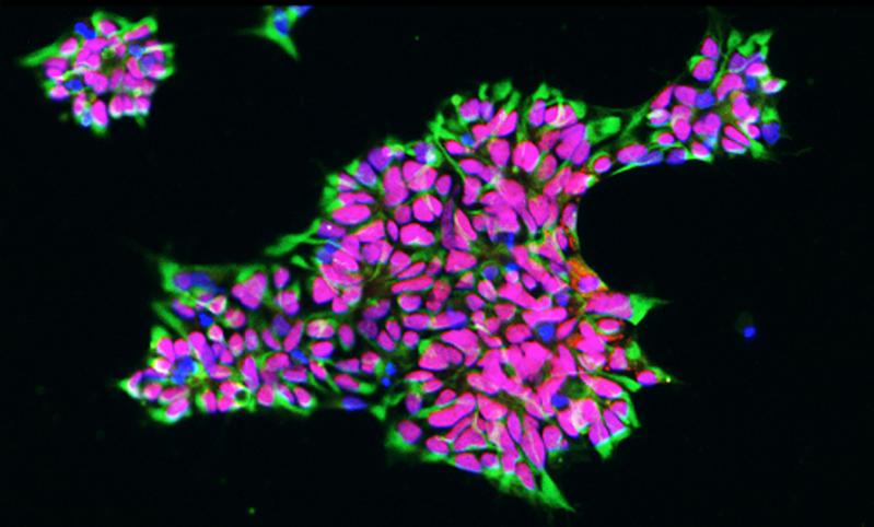 Humane induzierte neurale Stammzellen können aus Hautzellen hergestellt und unbegrenzt in der Petrischale gezüchtet werden.