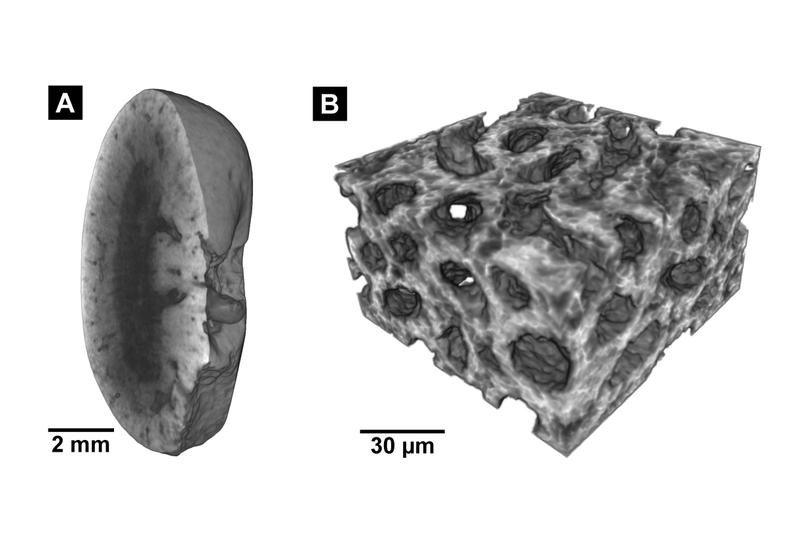 Links: Micro-CT-Aufnahme einer Mausniere, rechts: Nano-CT-Aufnahme des Gewebes. Die Färbemethode, die diese Bilder ermöglicht und das Nano-CT-Gerät wurden erstmals in PNAS beschrieben.