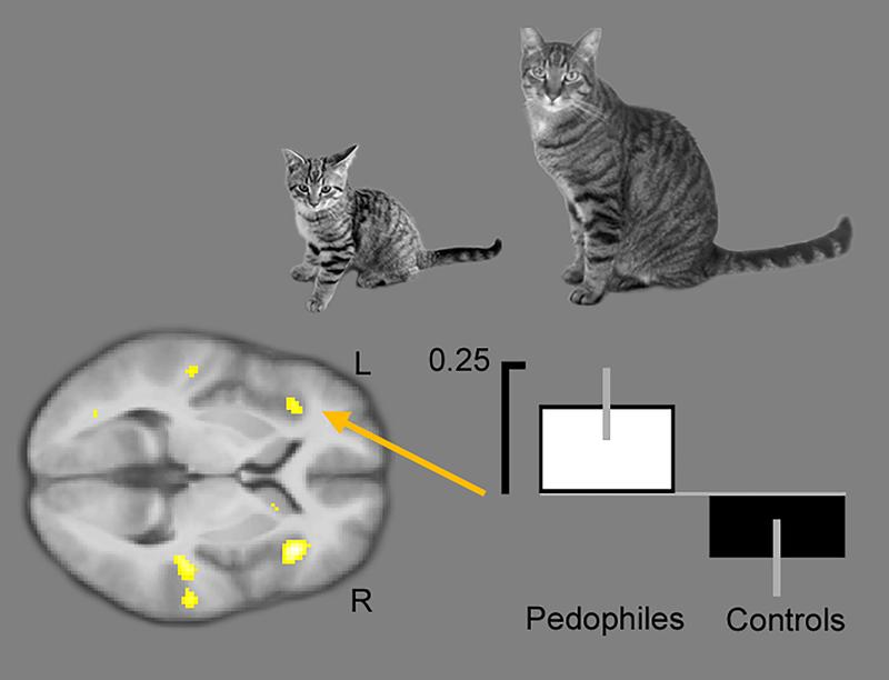 Looking at young animals compared to adult animals triggers increased activity in different areas of the brain in male pedophiles (yellow areas).