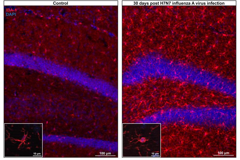 Gefräßige Mikrogliazellen (in rot): Wenn die Immunzellen des Gehirns überreagieren, verschlingen sie auch Teile von Nervenzellen. 