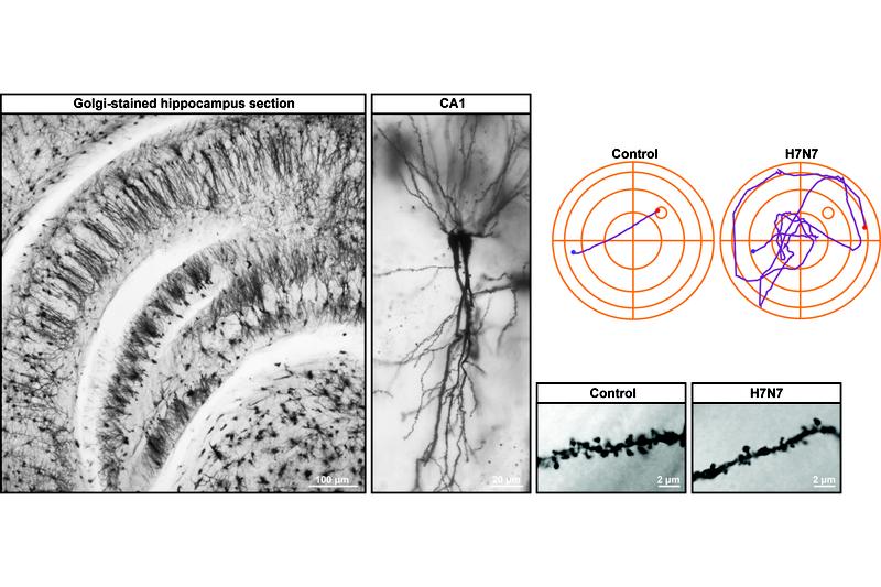 "Knubbel" zählen: Über die kleinen Pünktchen auf dem Mikroskopbild können die Forscher die Zahl der Synpasen im Hippocampus ermitteln. Der Hippocampus ist für das Lernen und Erinnern zuständig.