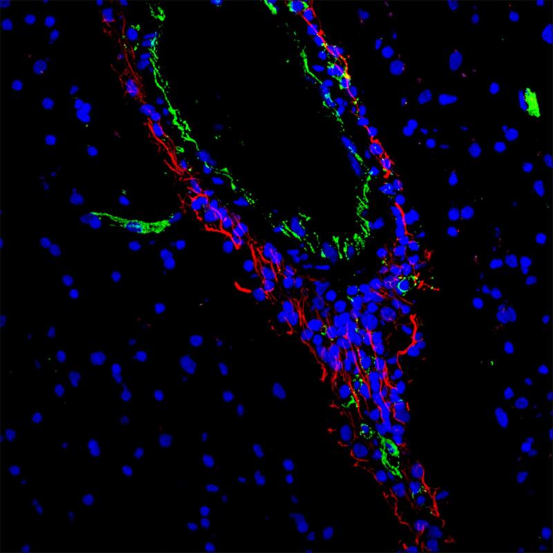 EGFL7 bindet Immunzellen an den perivaskulären Raum bei MS-Läsionen