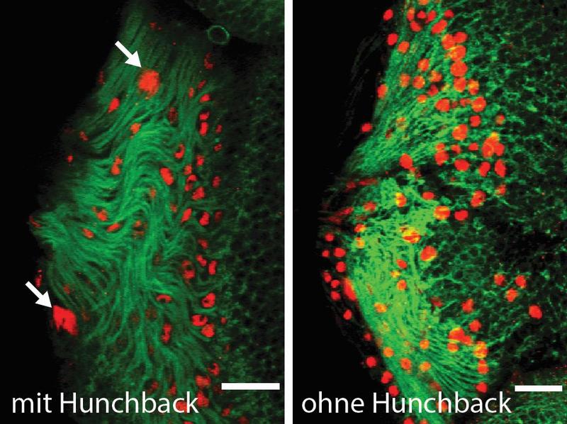 Gewebe, das später den Kopf bildet: Links die Zellen mit aktivem Hunchback in intaktem Gewebe, rechts das gleiche Gewebe von Fliegen, in denen die Funktion von Hunchback ausgeschaltet wurde.