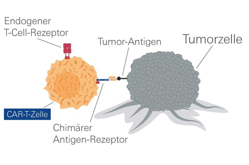 Durch einen Chimären Antigen-Rezeptor können T-Zellen Tumorzellen erkennen und zerstören.