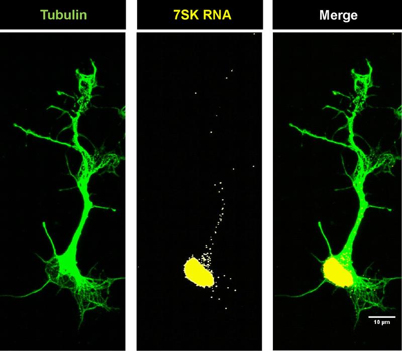 Lokalisation der 7SK-RNA in Motoneuronen, deren Form durch das Strukturprotein Tubulin dargestellt wurde.