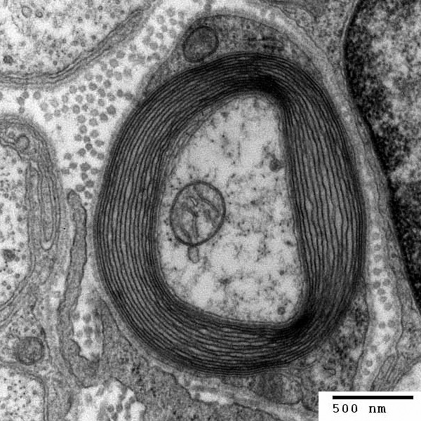 Elektronenmikroskopisches Bild der das Axon konzentrisch umgebenden Myelinscheide.