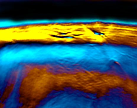 The new laser method MSOT represents brown fat.