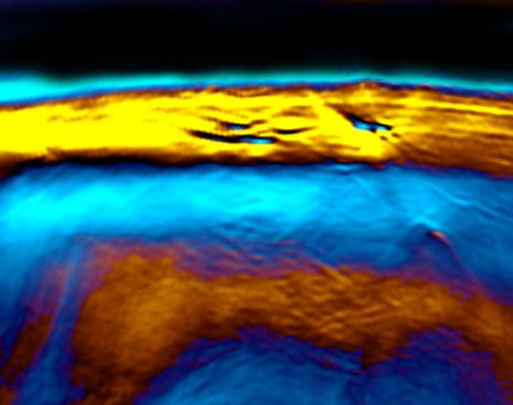 The new laser method MSOT represents brown fat.