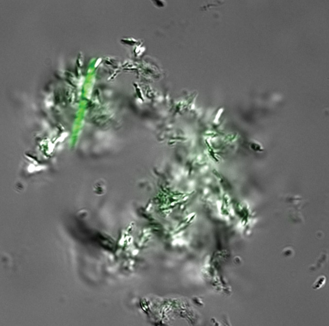 Fluoreszenzmikroskopische Aufnahme von DMN-Trehalose gefärbte Mycobacterium tuberculosis-Zellen. 