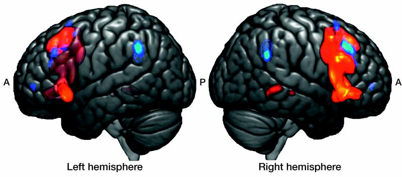 Das Pendant des für die Sprache zentralen Broca-Areals auf der rechten Hirnseite (rot) verarbeitet statt der Grammatik von Sprache die von Musik. Dabei ist auch das Arbeitsgedächtnis (blau) aktiv.