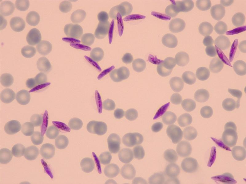 Giemsa Färbung von p. falciparum Gametocyten in humanen roten Blutzellen