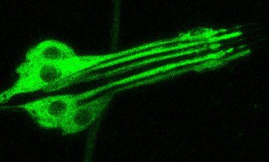 Mechanorezeptoren der Drosophila-Larve