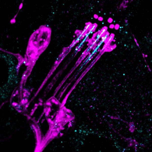 Opsin (light blue) in mechanoreceptors