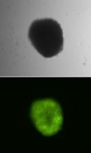 Durch Sleeping-Beauty-Transposons vermittelte stabile Expression eines Fluoreszenzmarkergens in blutbildenden Stammzellen. Oben Hellfeld, unten grüne Fluoreszenz. 