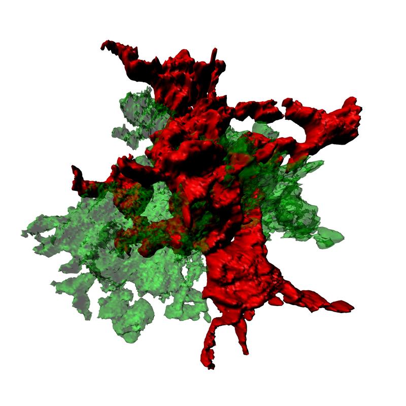 Fresszellen des Gehirns (Mikroglia – in rot) interagieren mit Ablagerungen (Amyloidplaques – in grün) im Rahmen der Alzheimer-Erkrankung und nehmen diese in sich auf.