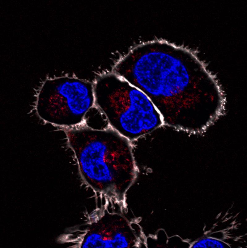 Artificial organelles in the scavenger cells of a zebrafish that were made visible by a fluorescent reaction.