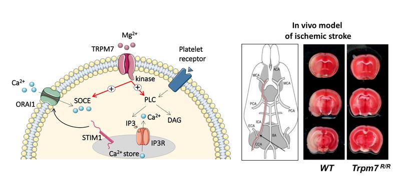 Mechanismus vom TRPM7-Protein (Abb. links) / Mäuse ohne TRPM7 (R/R) hatten erheblich weniger Hirngewebe geschädigt als die Kontrollmäuse (WT), nach einem induzierten Schlaganfall (Abb. rechts)