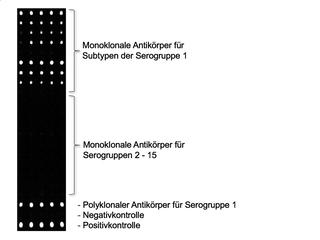 Sensorbild bei Nachweis von Legionella pneumophila Serogruppe 1, Stamm Bellingham-1