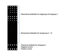 Sensor image indicating Legionella pneumophila serogroup 1, strain Bellingham-1 