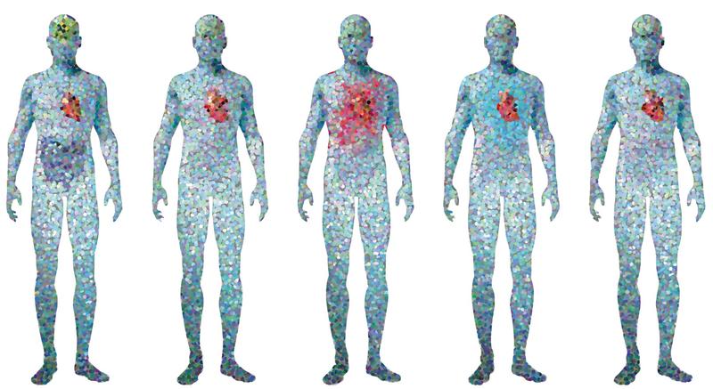 Mit Einzelzellbiologie will ein europäisches Konsortium einen Traum Wirklichkeit werden lassen:  Krankheiten und ihren Verlauf vorherzusagen