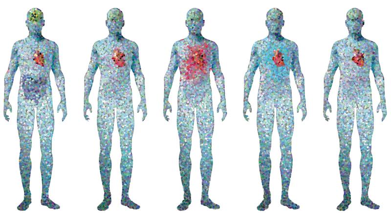 Mit Einzelzellbiologie will ein europäisches Konsortium einen Traum Wirklichkeit werden lassen:  Krankheiten und ihren Verlauf vorherzusagen