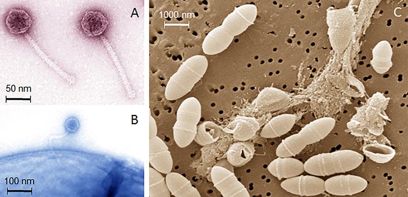 Elektronenmikroskopische Aufnahmen (A) von Bakteriophagen der Milchsäurebakterien, (B) eines Phagen nach der Anheftung an ein Bakterium und (C) von der Zerstörung der Bakterien durch die Phagen.
